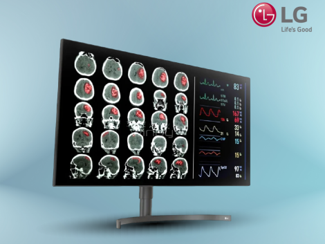 MonitorLG