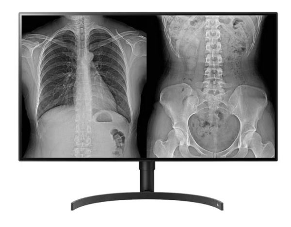 Monitor LG Diagnóstico 32 Pulgadas DUAL-DP (Distribuidores Autorizados LG Medical LATAM) - Imagen 4