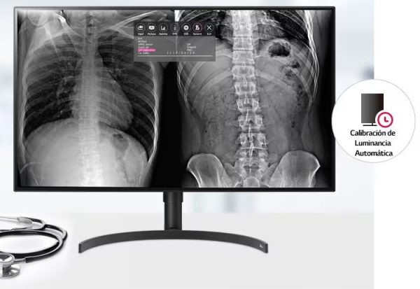 Monitor LG Diagnóstico 32 Pulgadas DUAL-DP (Distribuidores Autorizados LG Medical LATAM) - Imagen 3