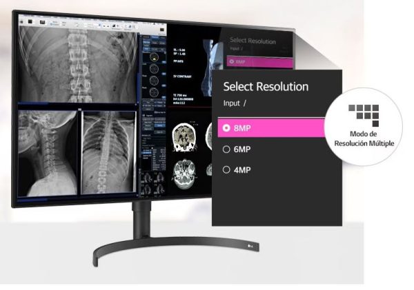 Monitor LG Diagnóstico 32 Pulgadas DUAL-DP (Distribuidores Autorizados LG Medical LATAM) - Imagen 2