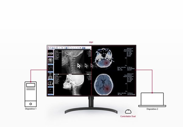 Monitor LG Diagnóstico 32 Pulgadas DUAL-DP (Distribuidores Autorizados LG Medical LATAM) - Imagen 5